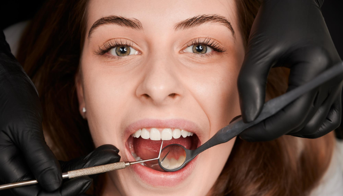 Why Do I Get Cavities Even When I Don’t Eat Sweets?