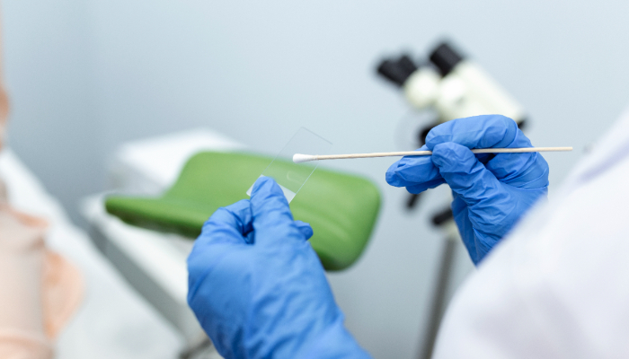 Pap Smear Test